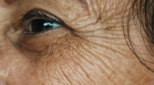 PRO-AGING, WELL-AGING, AND ANTI-AGING? WHAT ARE THEY AND WHY DOES IT MATTER?